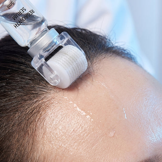 Hair Regrowth Microneedle Serum Kit for Scalp Care and Anti-Hair Loss